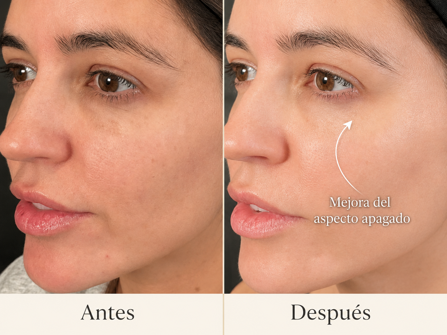Antes y después: mejora del aspecto apagado