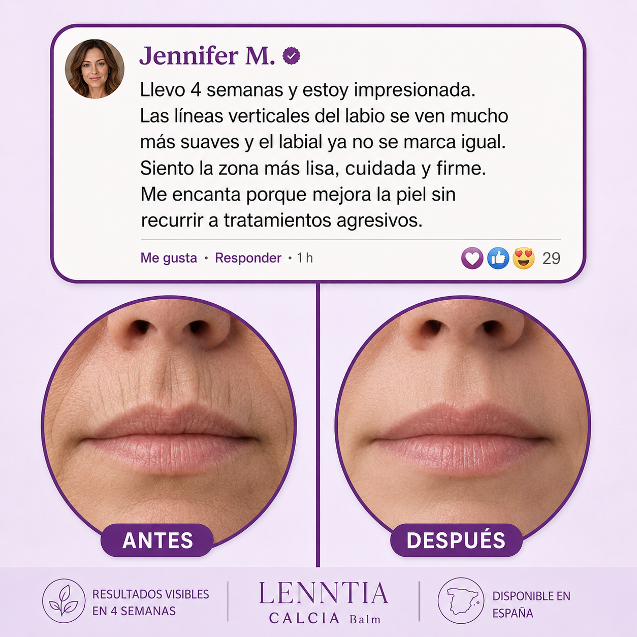 Testimonio antes y después CALCIA Balm